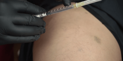 Curso PEIM Microvasos Online