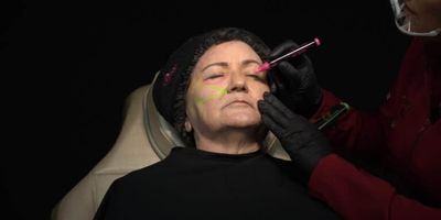 Curso Harmonização Facial Pugacode® | WV45® Online