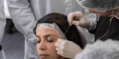 Curso Fios PDO Facial